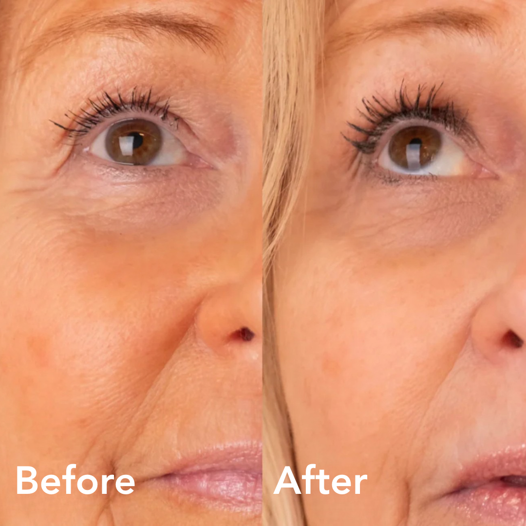 Eyelash Growth Serum